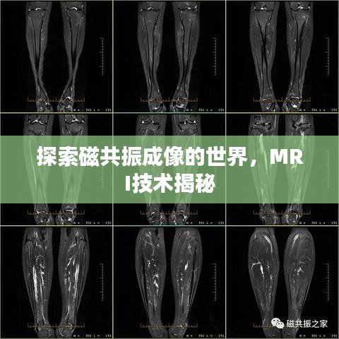 探索磁共振成像的世界，MRI技术揭秘
