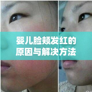 婴儿脸颊发红的原因与解决方法——百度权威解答