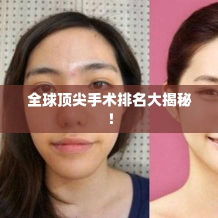 全球顶尖手术排名大揭秘！