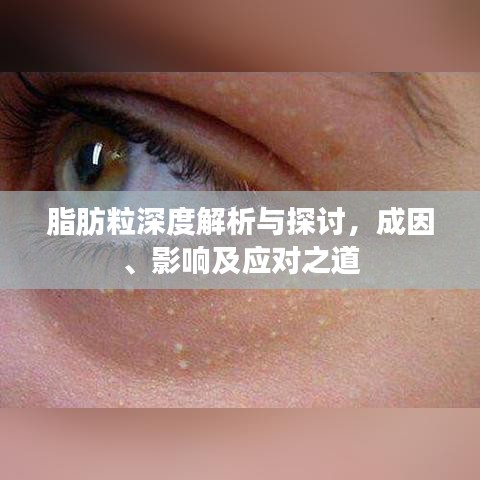 脂肪粒深度解析与探讨，成因、影响及应对之道